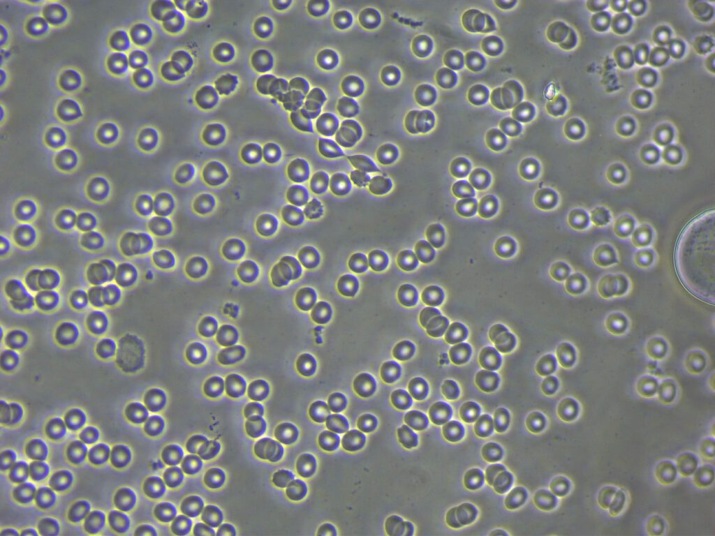 Wendy Baseline 40x Copy